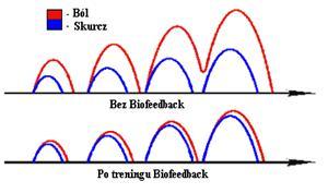 BIOFEEDBACK EEG, EMG, RSA, WROCŁAW, dolnośląskie