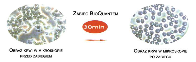 BIOQUANT- 