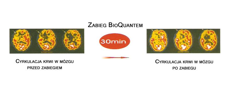 BIOQUANT- 