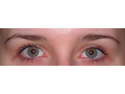 Oczy przed mikropigmentacją - kliknij, aby powiększyć