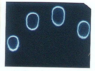 Fotografia Kirlianowska promieniowania emanującego  z palców mojej ręki - kliknij, aby powiększyć