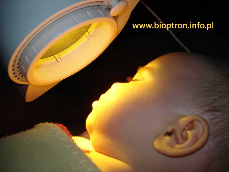 Bioptron w pediatrii