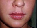 kontur ust, efekt tuż po zabiegu, kolor docelowy o ton ciemniejszy od naturalnego koloru ust