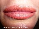 kontur ust z ceniowaniem, odcień naturalny, usta uprzednio powiększone botoxem
