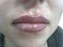 zabieg mikropigmentacji ust (efekt widoczny bezpośrednio po zabiegu)