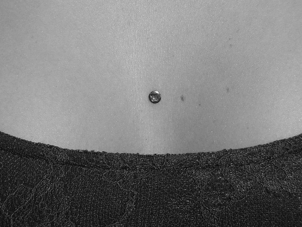 microdermal dekolt