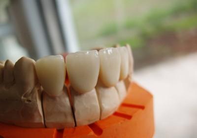 Bezpłatne protezy zębowe i leczenie dentystyczne, Szczecin, zachodniopomorskie