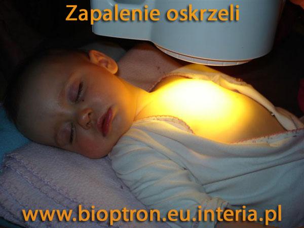 Lampy Bioptron, rehabilitacja,swiatłoterapia, Kraków, małopolskie