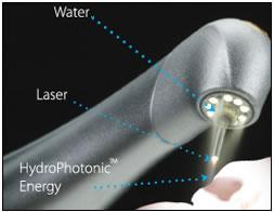Energia kinetyczna lasera czyni zabieg bezbolesnym 