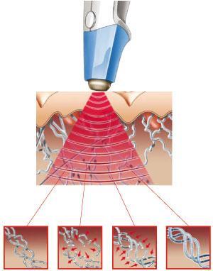 Odmładzanie,mezoterapia,,Dr Grandel-Józefów , mazowieckie