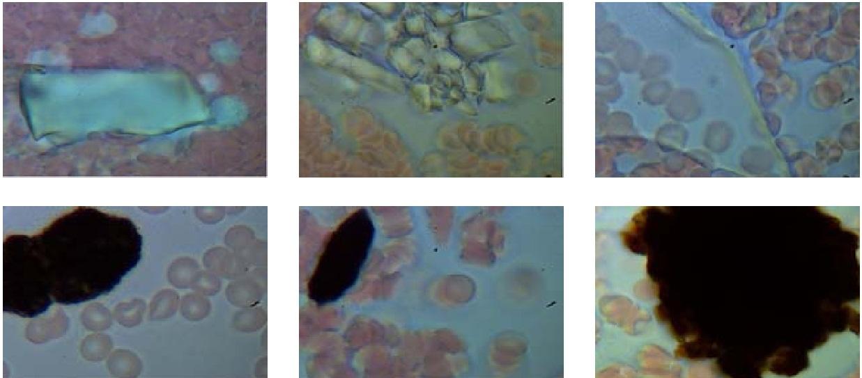 Badania żywej kropli krwi, szkolenia, diagnostyka, Wrocław, Gajków, dolnośląskie