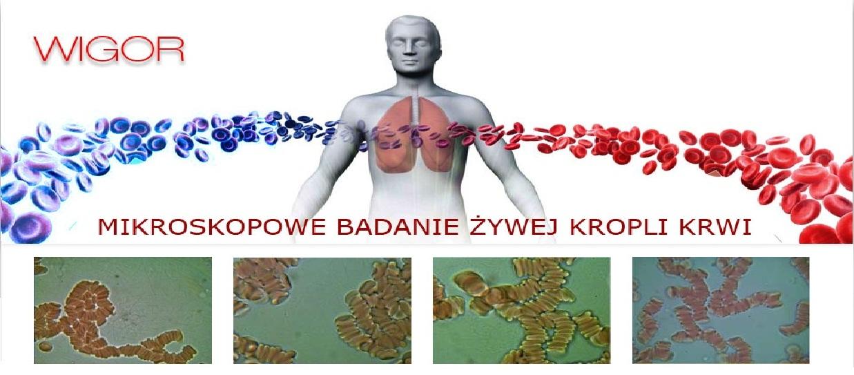 Badania żywej kropli krwi, szkolenia, diagnostyka, Wrocław, Gajków, dolnośląskie