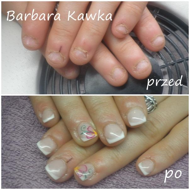 NAJLEPSZE PAZNOKCIE , TIPSY , MANICURE HYBRYDOWY W MIEŚCIE ! ZABIEGI !, Tarnowskie Góry, śląskie