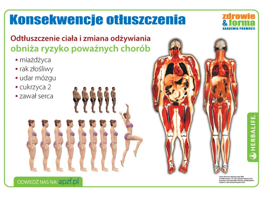 Jakie konsekwencje może powodować nadmiar tłuszczu w ciele