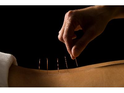 akupunktura - kliknij, aby powiększyć