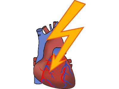 Arytmia serca - czym jest i jak ją rozpoznać