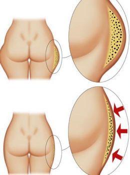 Zdrowie, uroda, spa, likwidacja cellulitu, depilacja laserowa, Warszawa, mazowieckie