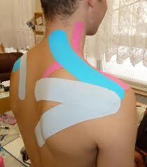 Kinesiotaping