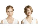 Hair Again System  Zagęszczanie włosów zamiast przeszczepu włosów, cała Polska