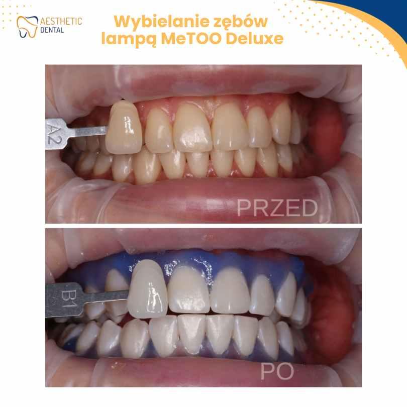 Aesthetic Dental stomatolog ortodonta implanty Piotrków Trybunalski, - Piotrków Trybunalski, łódzkie