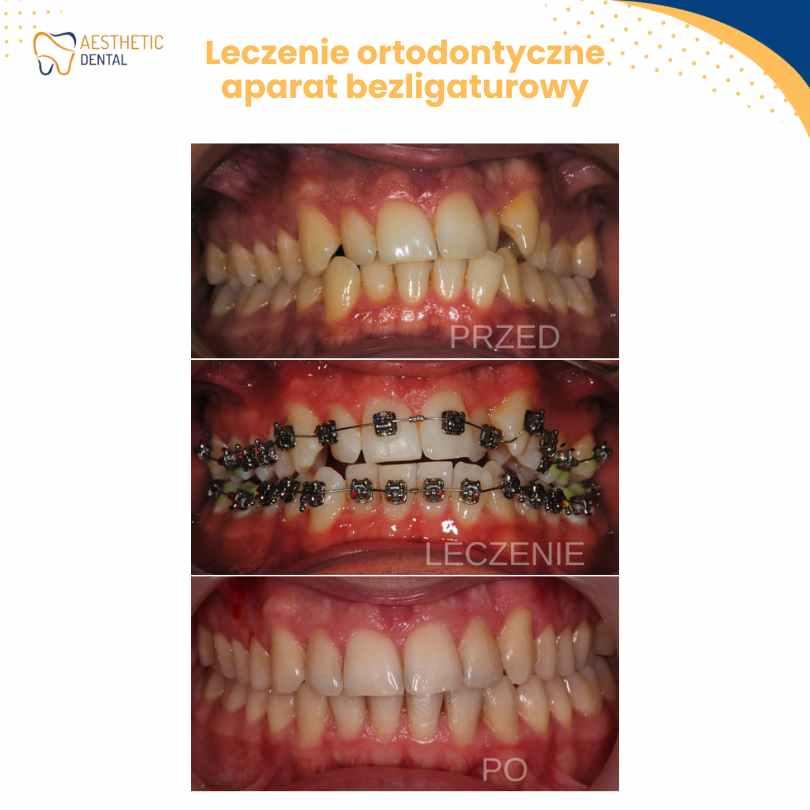 Aesthetic Dental stomatolog ortodonta implanty Piotrków Trybunalski, - Piotrków Trybunalski, łódzkie